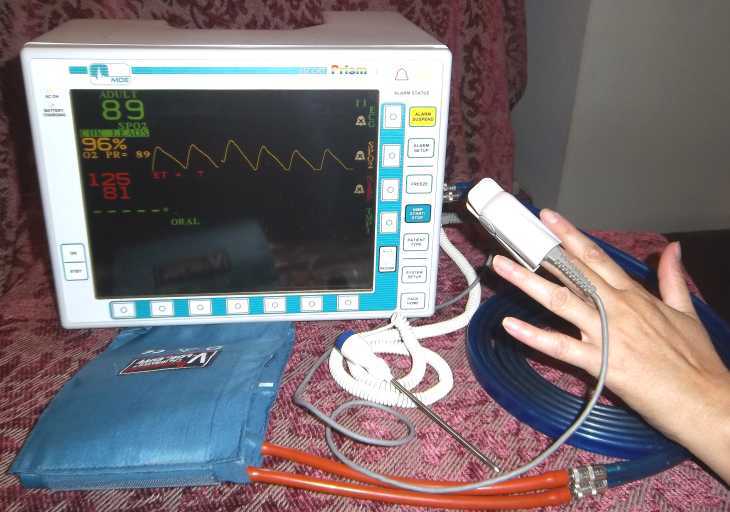 Used Medical Data Electronics monitor monitors blood pressure ekg ecg spo2